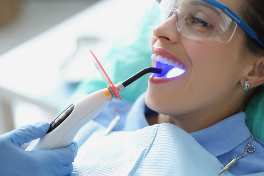 Wybielanie zębów Poznań to zachodzący na powierzchni szkliwa zębów proces utlenienia